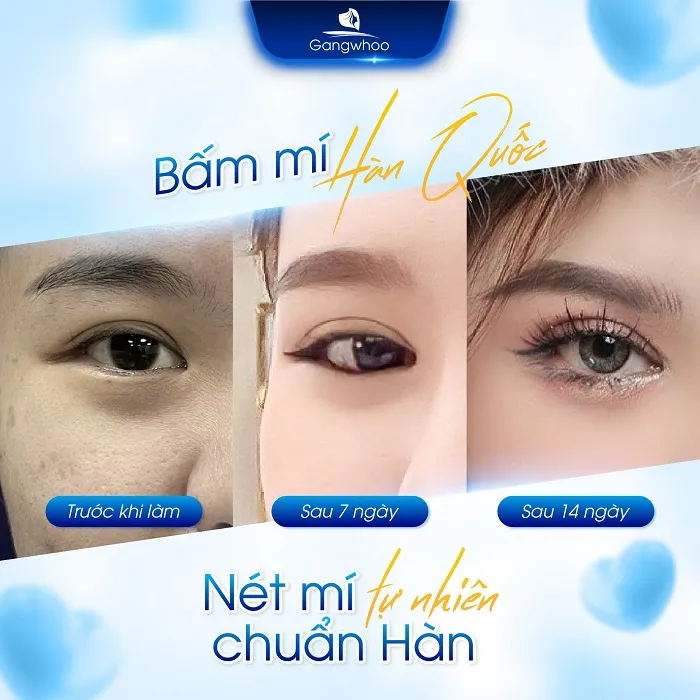 Đôi mắt 2 mí hoàn hảo theo tiêu chuẩn thẩm mỹ Hàn Quốc