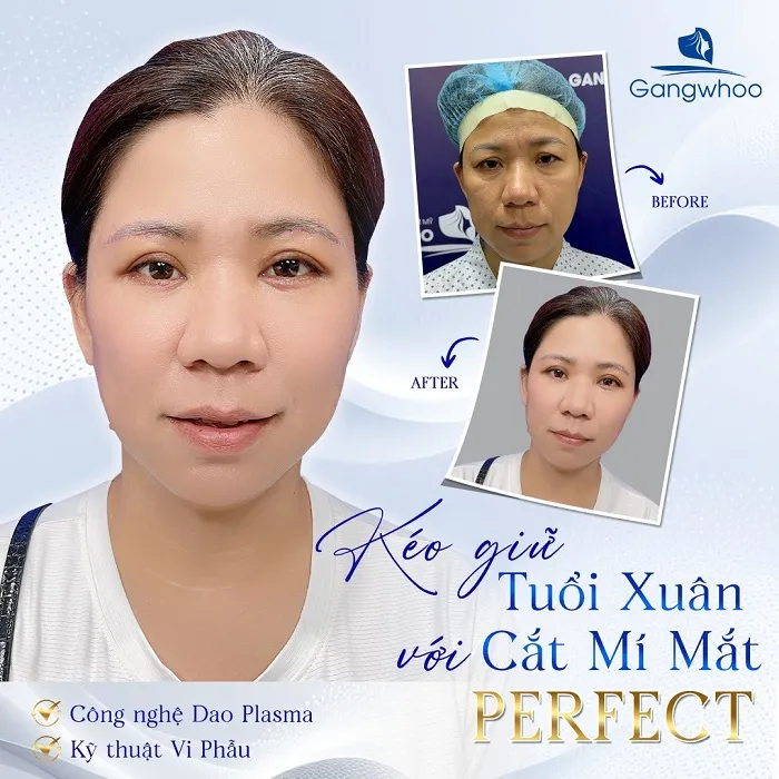 Sở hữu đôi mắt 2 mí rõ nét, ưng ý tại Gangwhoo