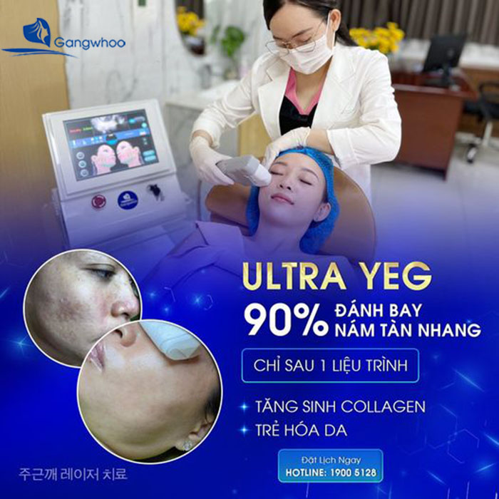 Công nghệ Ultra YEG với cơ chế hoạt động thông minh, sử dụng các tia laser nhẹ nhàng tác động vào vùng da nám