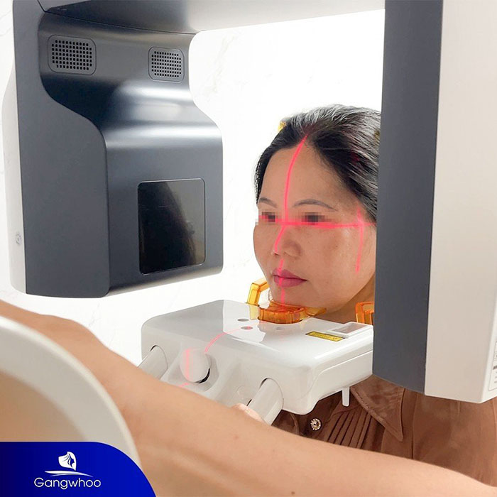 Ứng dụng công nghệ X-Quang AI điện toán vào độn cằm
