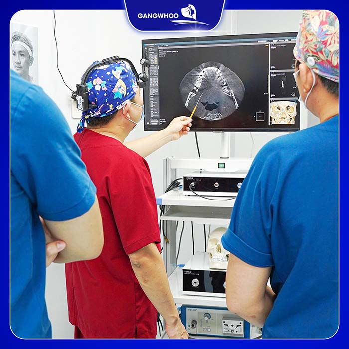 Đội ngũ bác sĩ đang chẩn đoán trước khi tiến hành độn cằm