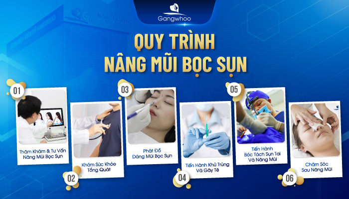 Quy trình nâng mũi bọc sụn tại TMV Gangwhoo