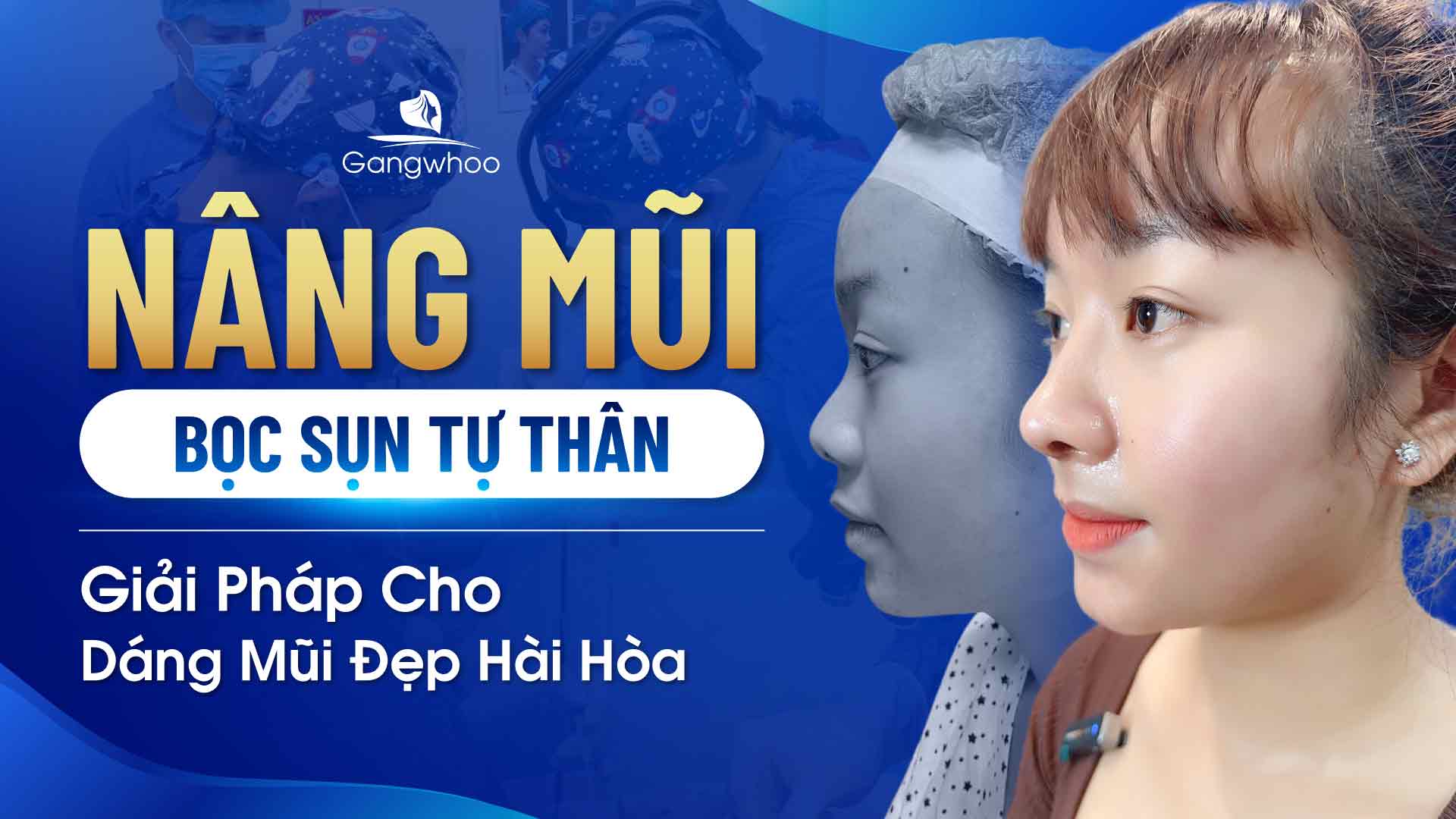 Nâng mũi bọc sụn tự thân là gì? Tìm hiểu ngay!