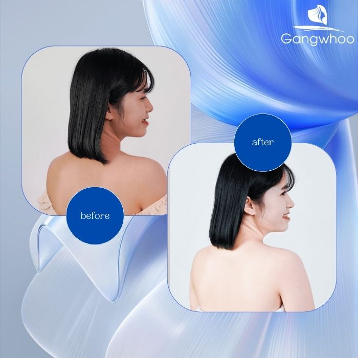 Công nghệ White Skin của Gangwhoo an toàn với mọi loại da