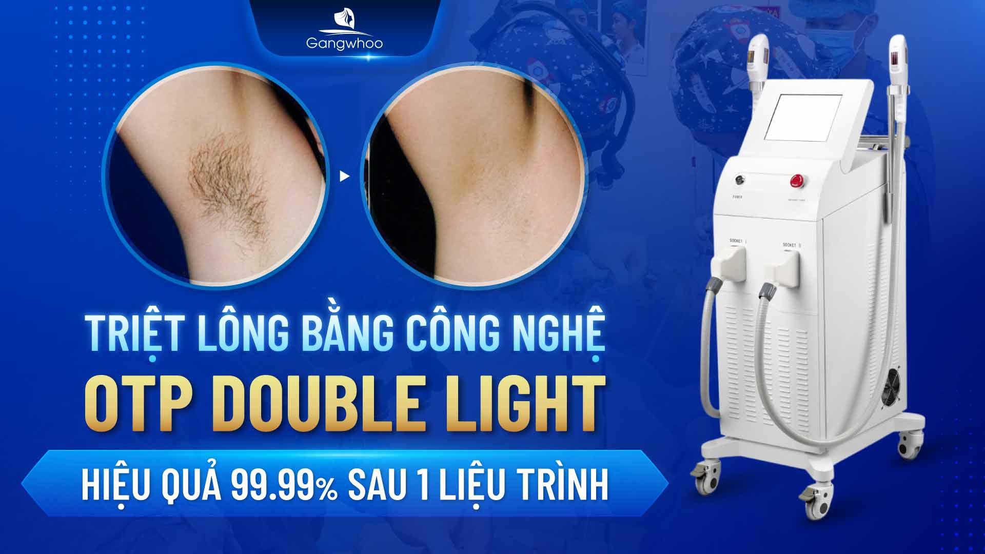 Lông thô cứng đã làm mất đi sự tự tin quyến rũ của hội chị em