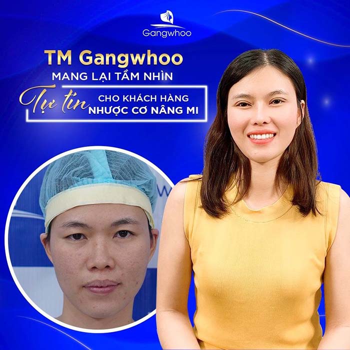 TMV Gangwhoo mang lại tầm nhìn cho khách hàng