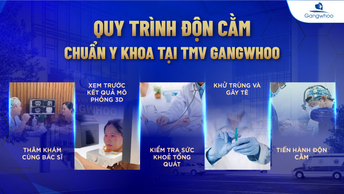 Độn cằm chuẩn Y khoa tại Gangwhoo