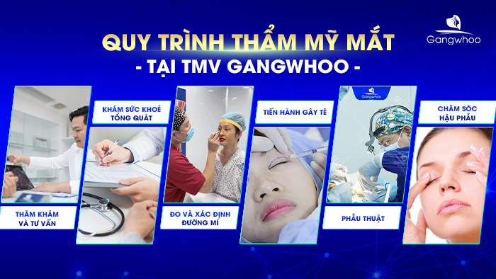 Quy trình thẩm mỹ mắt chuẩn Y khoa