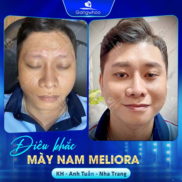 ộ bền của điêu khắc chân mày kéo dài khoảng 3 - 5 năm, tùy vào cơ địa từng người.