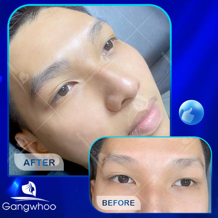 Điêu Khắc Chân Mày 6DCho Nam Đẹp Tự Nhiên Nam Tính