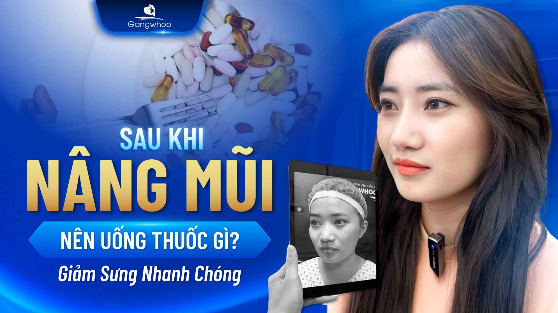 Sau Khi Nâng Mũi Nên Uống Thuốc Gì? Giảm Sưng Nhanh Chóng