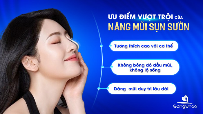 Ưu điểm vượt trội của nâng mũi sụn sườn
