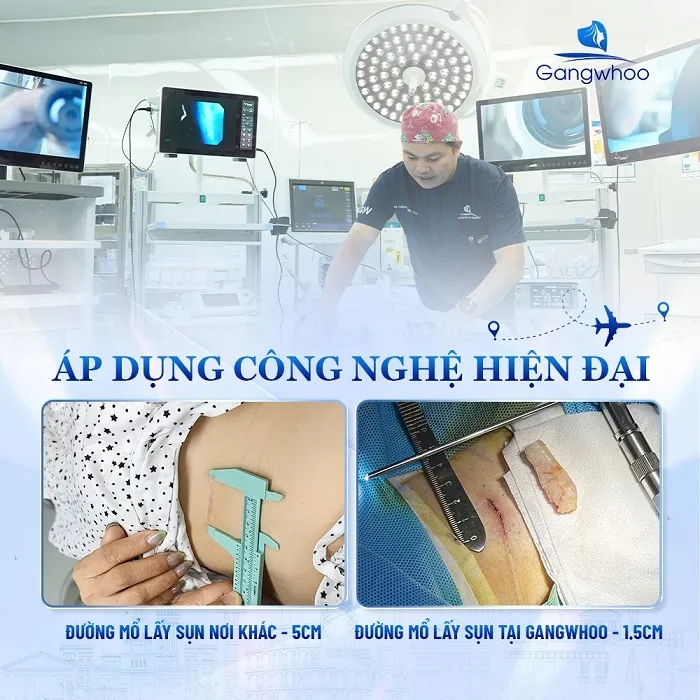 Gangwhoo luôn cập nhật và áp dụng công nghệ hiện đại