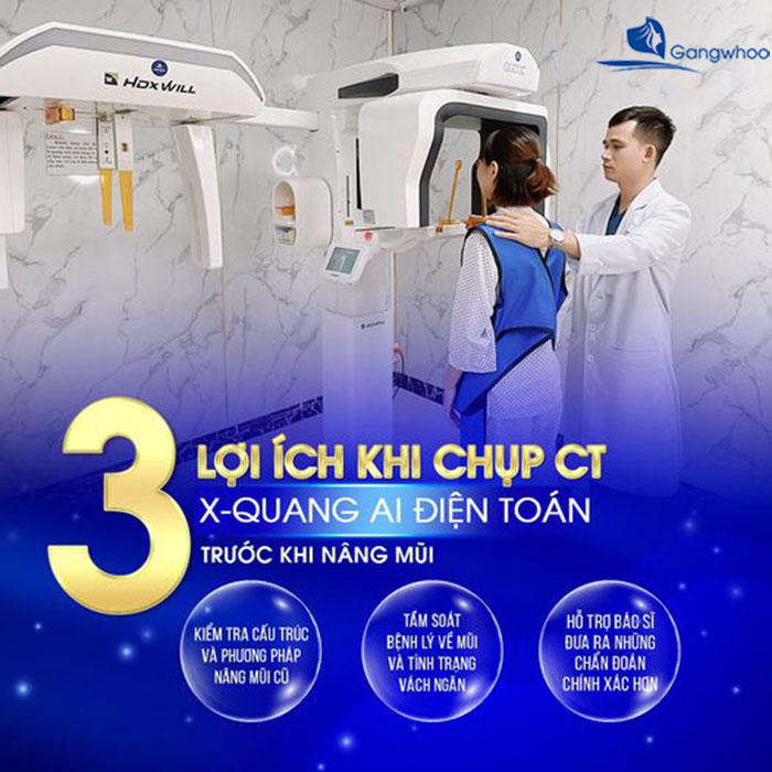 TMV Gangwhoo ứng dụng công nghệ X-Quang AI điện toán vào nâng mũi
