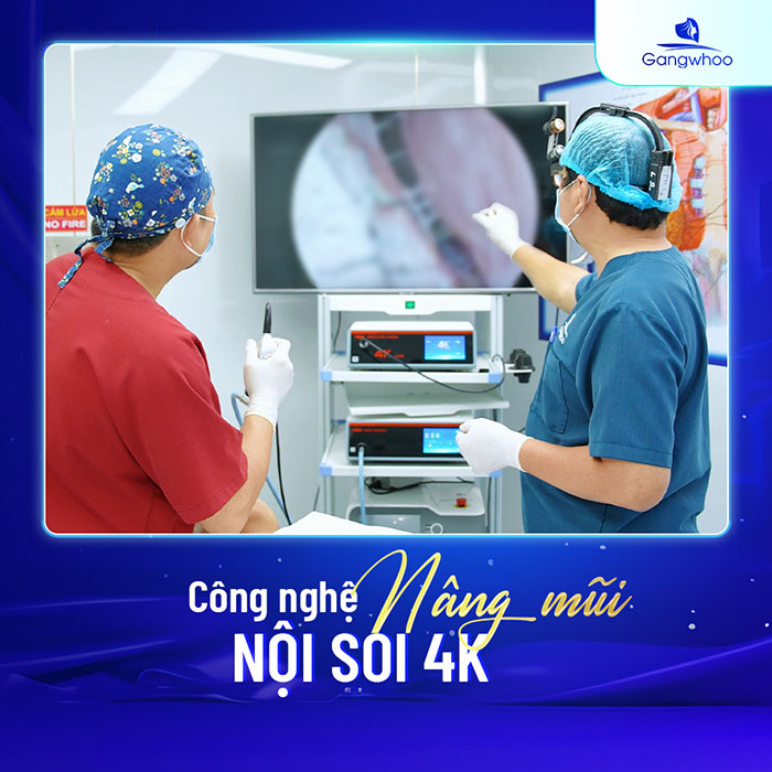Hệ thống nội soi 4K giúp quá trình nâng mũi diễn ra nhẹ nhàng