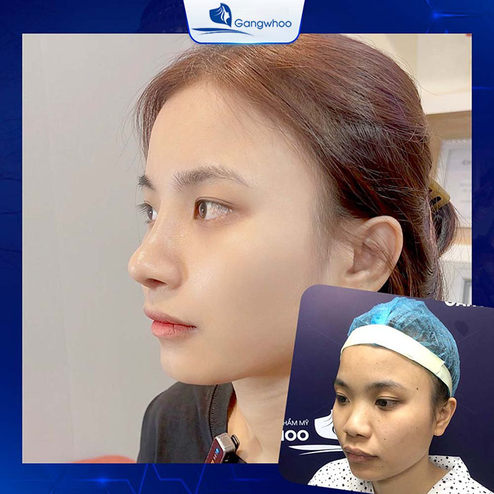Bạn chỉ nên ăn thịt ếch sau khi vết thương đã hồi phục hoàn toàn