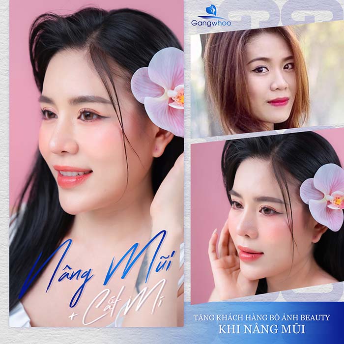 Dáng mũi đẹp thay đổi toàn bộ khuôn mặt