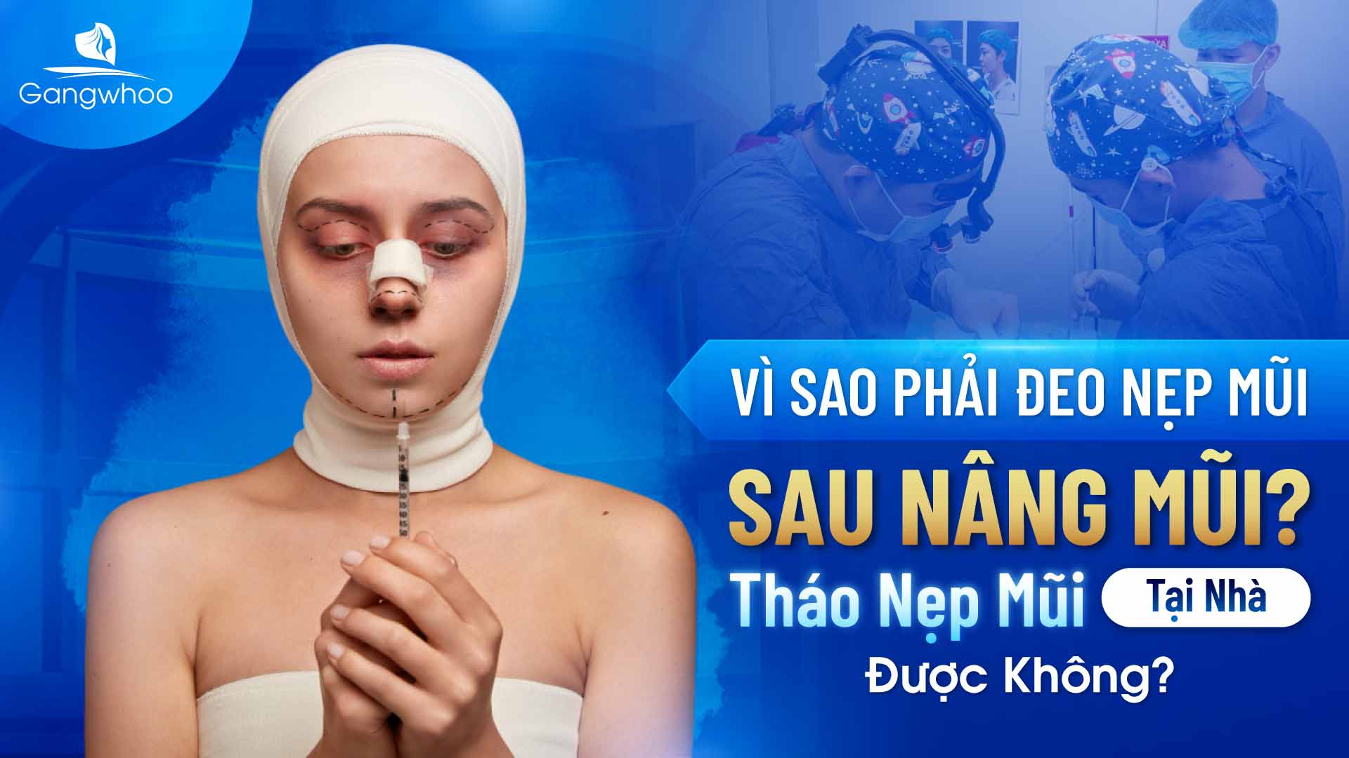 Nẹp nâng mũi giúp giữ sụn nâng mũi cố định
