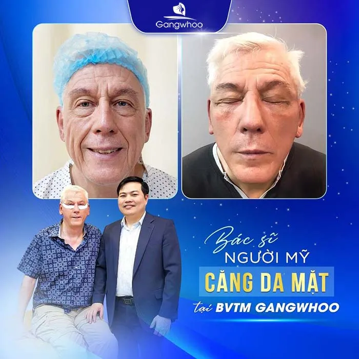 Top 5 Bệnh Viện Thẩm Mỹ Căng Da Mặt Uy Tín Tại TP. HCM