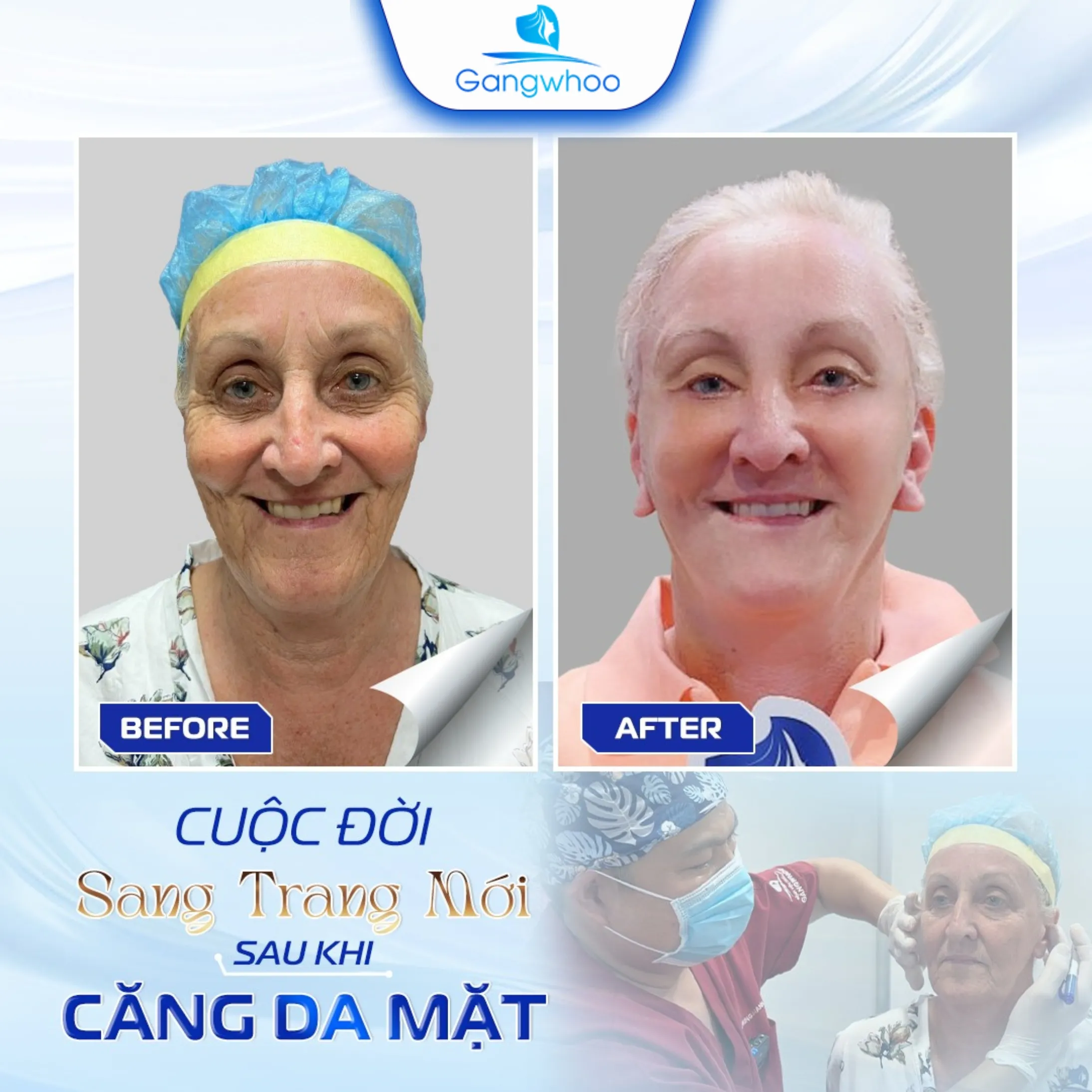 Top 5 Bệnh Viện Thẩm Mỹ Căng Da Mặt Uy Tín Tại TP. HCM