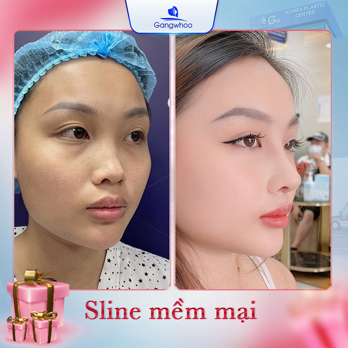 Dáng S-line tự nhiên phù hợp với đa số người Châu Á