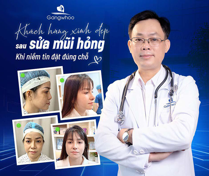 Gangwhoo tiếp nhận những trường hợp sửa mũi hỏng, cải thiện mọi vấn đề mũi khó.