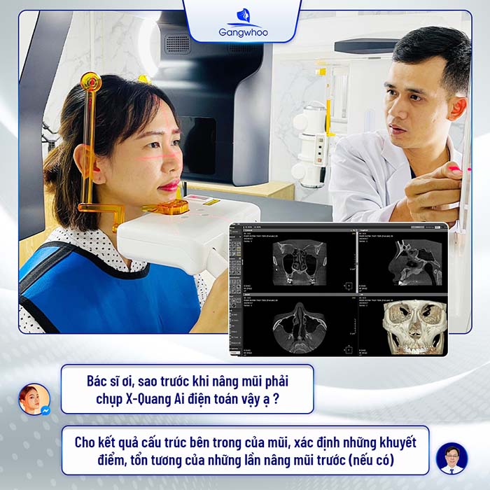 TMV Gangwhoo ứng dụng công nghệ X-Quang AI điện toán vào nâng mũi