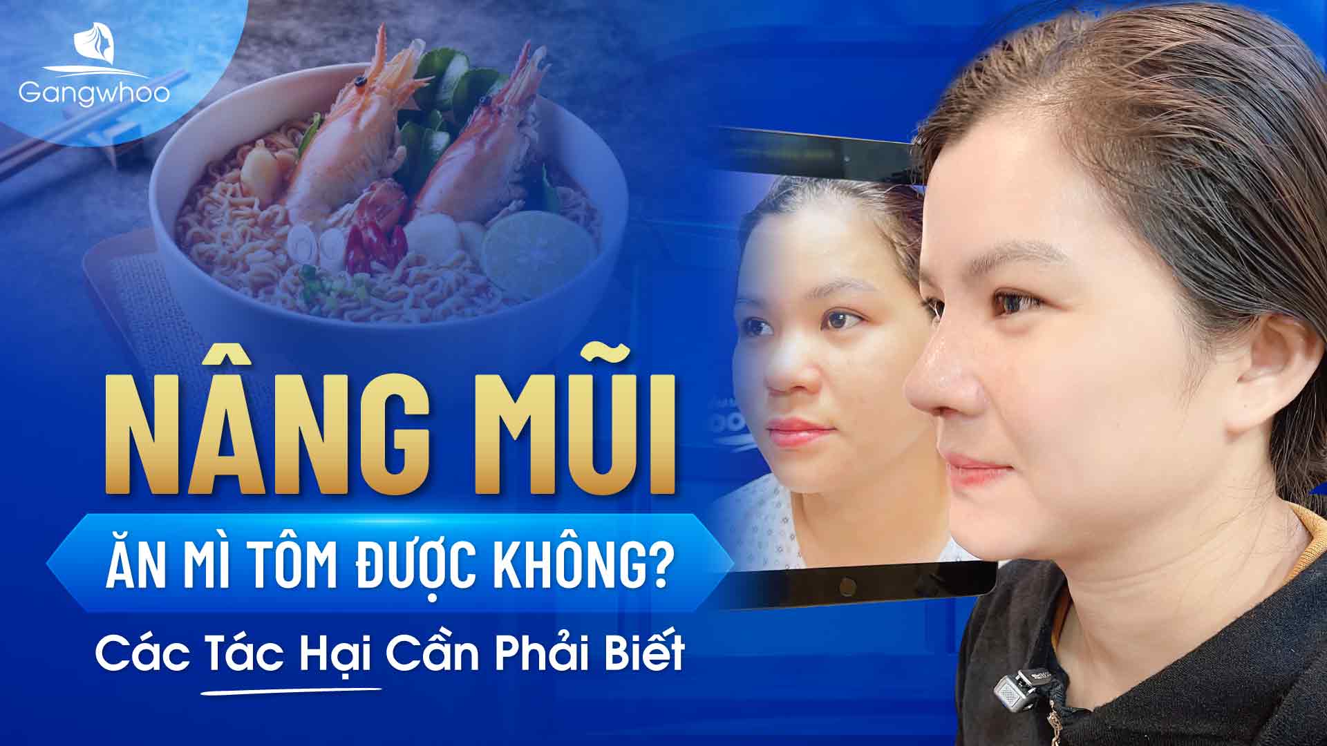 Nâng Mũi Ăn Mì Tôm Được Không? Các Tác Hại Cần Phải Biết