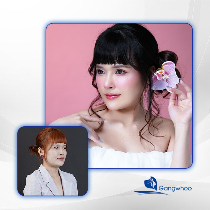 Gangwhoo - Kiến tạo dáng mũi đẹp chuẩn tỷ lệ
