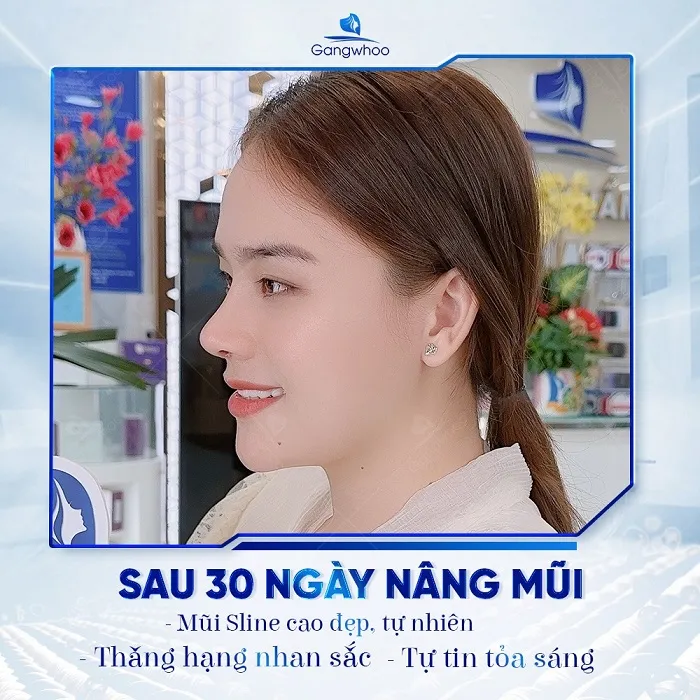 Dáng mũi S-Line mềm mại, phù hợp với người Châu Á