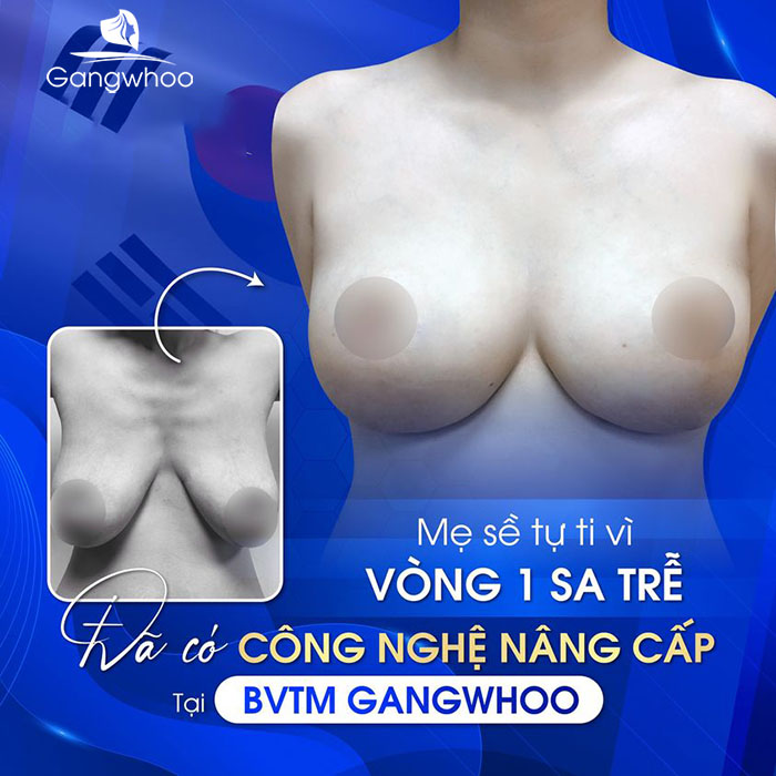 Giá treo sa trễ ngực dao động 45.000.000 - 65.000.000