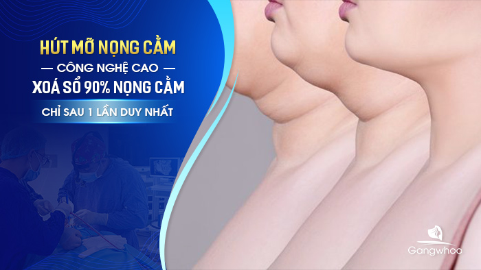 Hút mỡ nọng cằm công nghệ cao chỉ có tại Gangwhoo