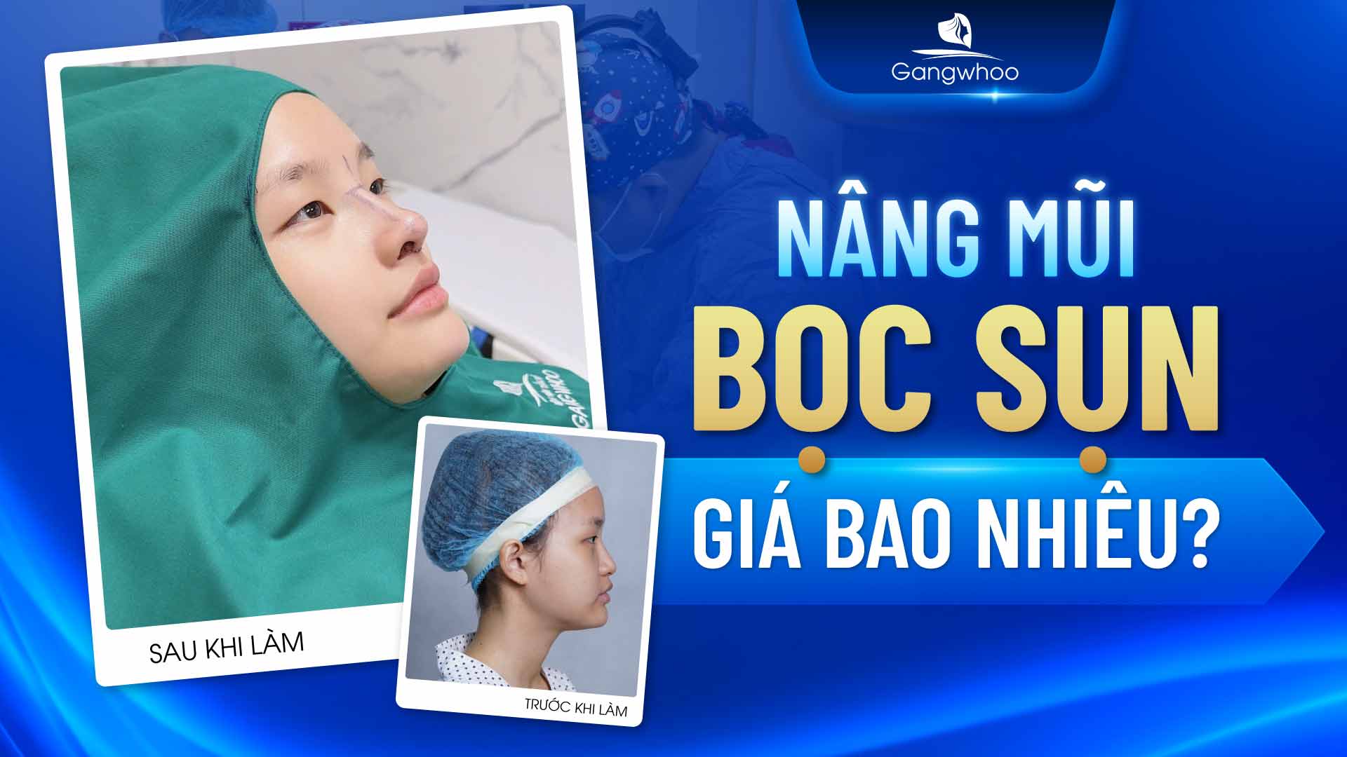 Nâng mũi GIÁ HẤP DẪN tại TMV Gangwhoo