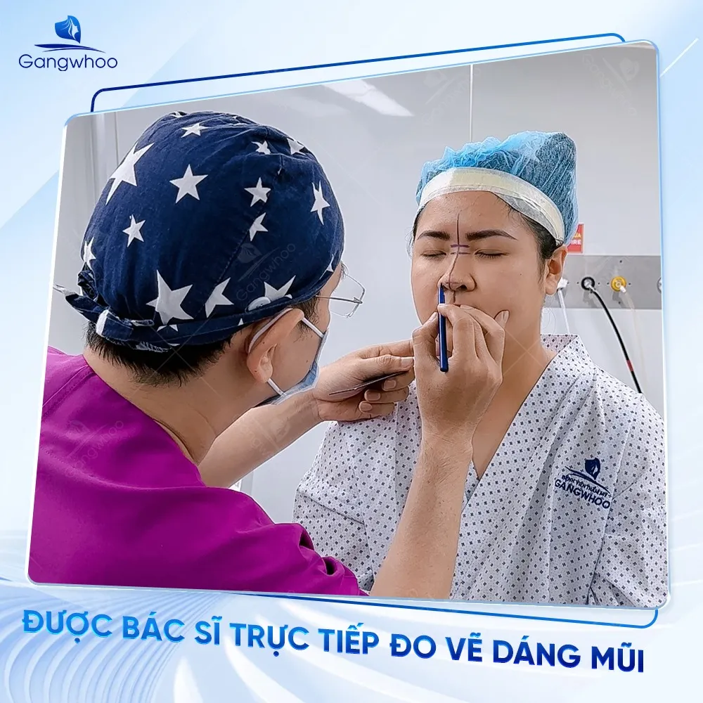 Bác sĩ tiến hành đo vẽ dáng mũi