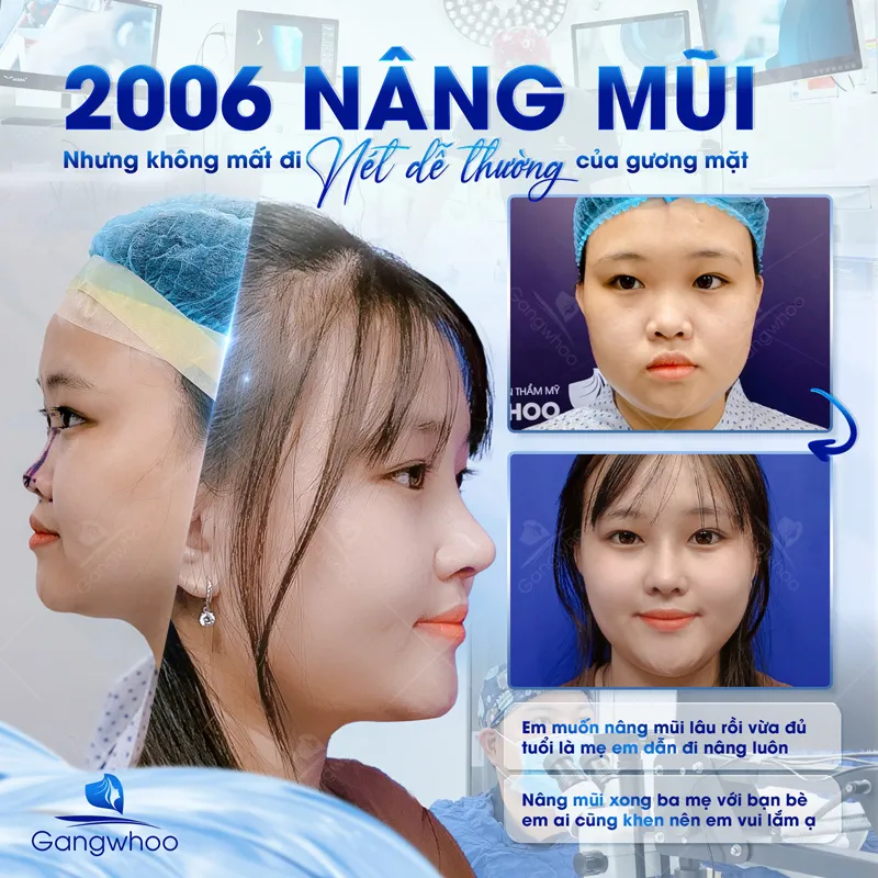 Nhiều khách hàng trong và ngoài nước tin tưởng lựa chọn Gangwhoo để nâng mũi