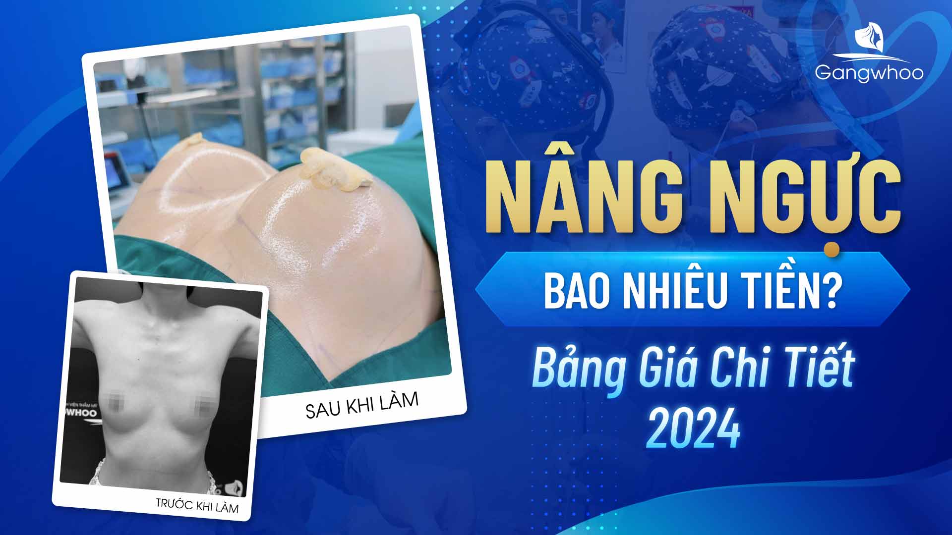 Nâng ngực bao nhiêu tiền?