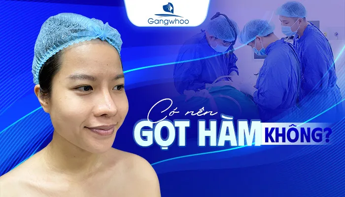 Có Nên Gọt Hàm Không? Khi Nào Mới Nên Gọt Hàm?