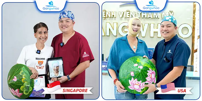 Có Nên Gọt Hàm Không? Gọt Hàm Có Ảnh Hưởng Về Sau Không?