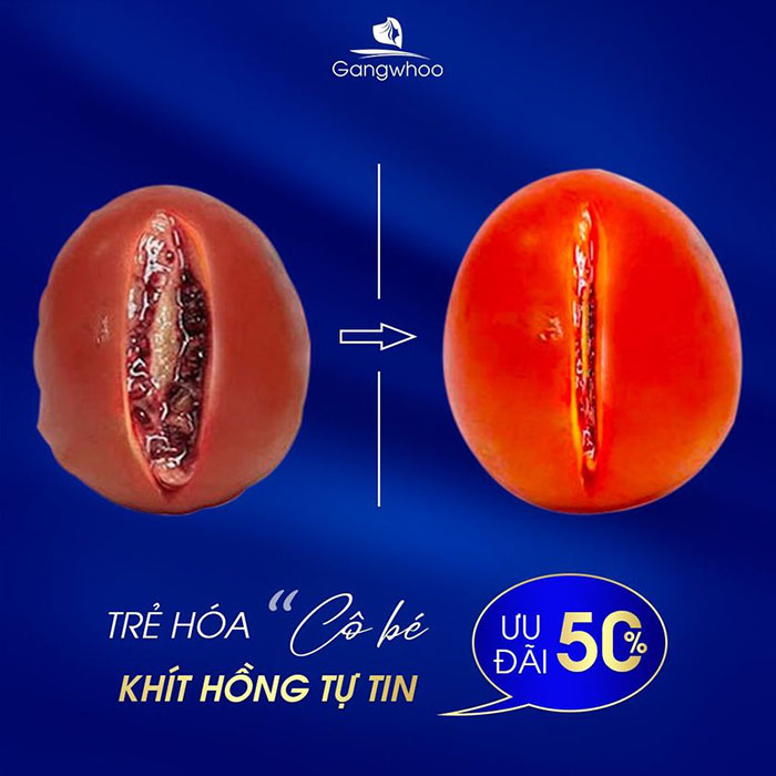 Ưu đãi thẩm mỹ "cô bé" tại TMV Gangwhoo