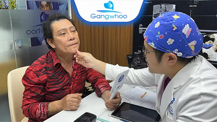 Giải Đáp: Gọt Hàm Sau Bao Lâu Thì Hết Tê?