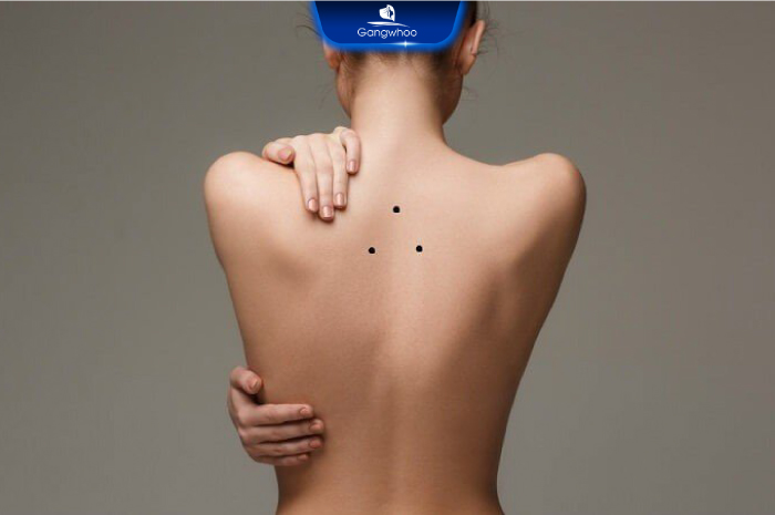 Ý Nghĩa Nốt ruồi Sau Lưng Nam Và Nữ