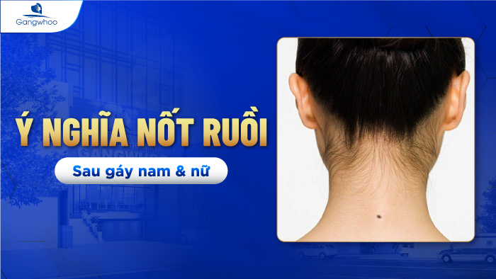Nốt ruồi sau gáy nam - Ý nghĩa và tẩy nốt ruồi