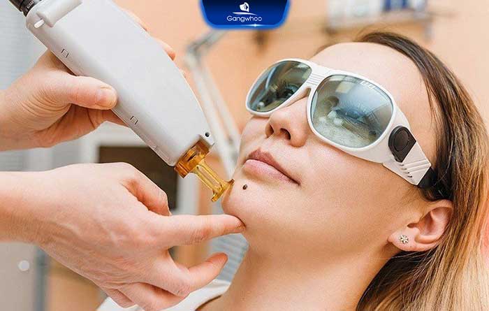 Nốt ruồi ở rốn: Ý nghĩa, tư vấn địa chỉ tẩy nốt ruồi uy tín