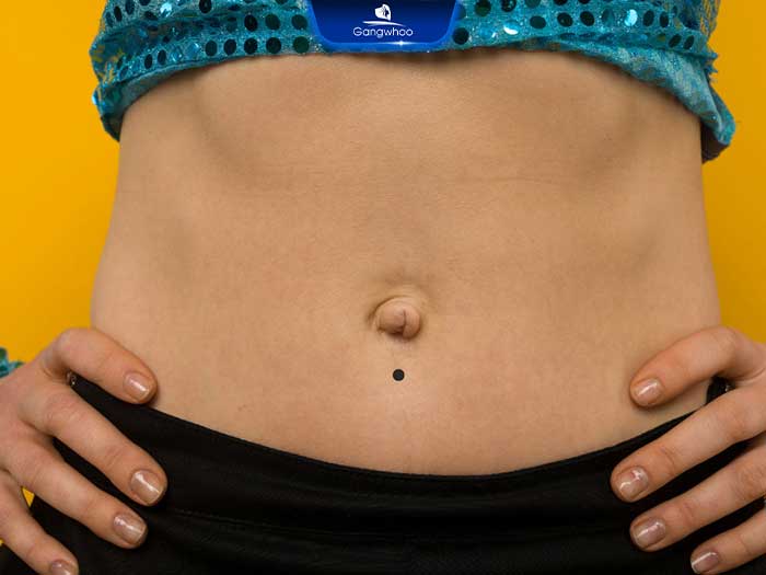 Nốt ruồi ở rốn: Ý nghĩa, tư vấn địa chỉ tẩy nốt ruồi uy tín