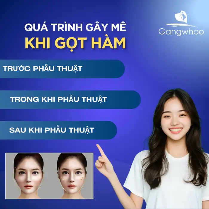 Gọt Hàm Hôn Mê Bao Lâu? Quy Trình Gây Mê Bạn Nên Biết?