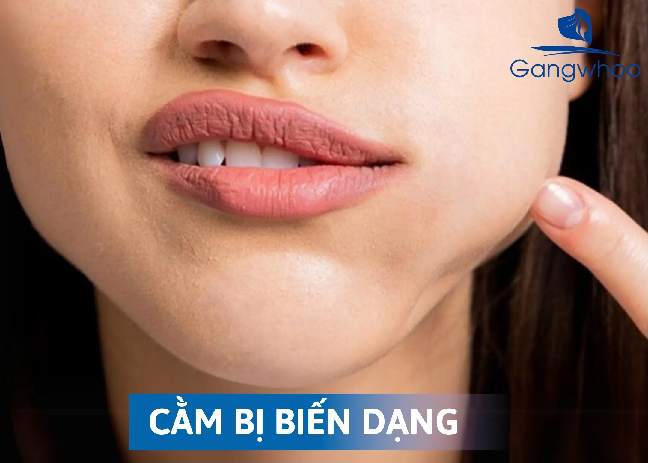 Những Tác Hại Của Trượt Cằm Mang Lại Sau Phẫu Thuật? 