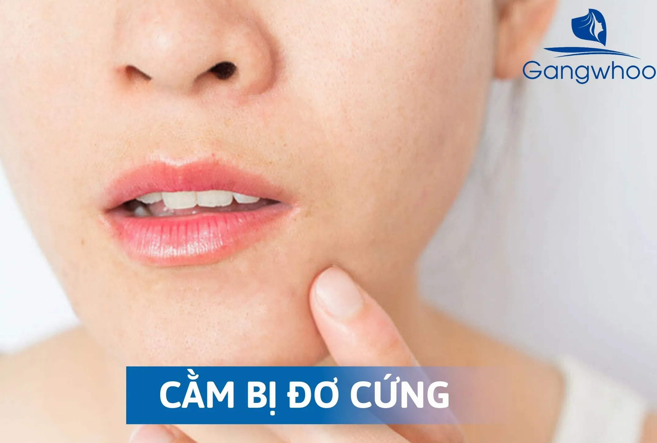 Những Tác Hại Của Trượt Cằm Mang Lại Sau Phẫu Thuật? 