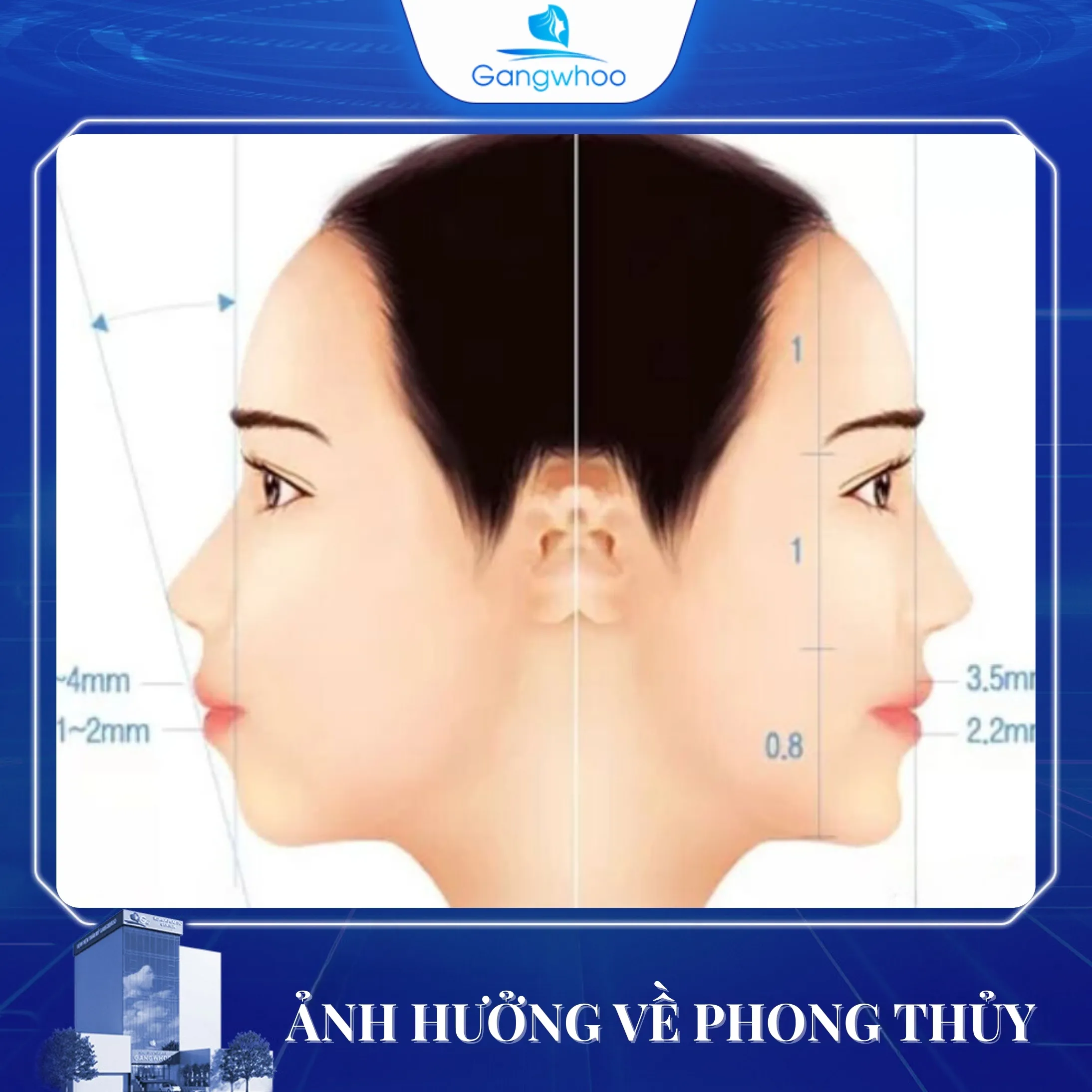 Trượt Cằm Có Ảnh Hưởng Về Lâu Dài Không?