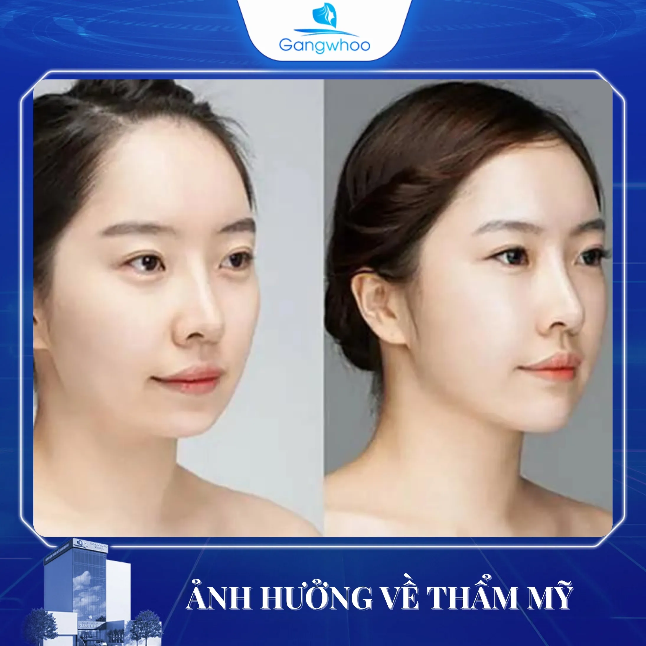 Trượt Cằm Có Ảnh Hưởng Về Lâu Dài Không?