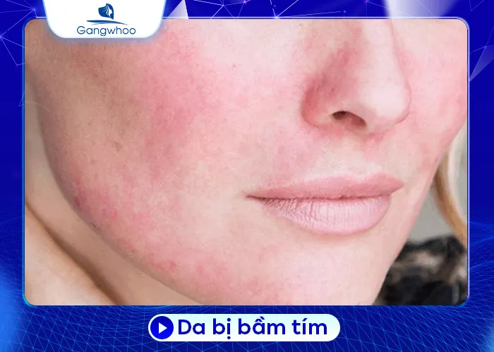 Những Biến Chứng Khi Căng Da Mặt Mà Bạn Nên Lưu Ý